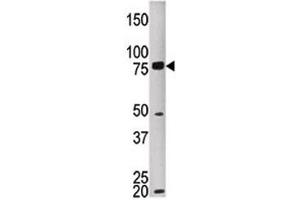 Western blot testing of MELK antibody and HEPG2 lysate.