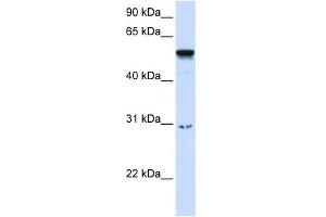 WB Suggested Anti-AIRE Antibody Titration:  0. (AIRE anticorps  (Middle Region))