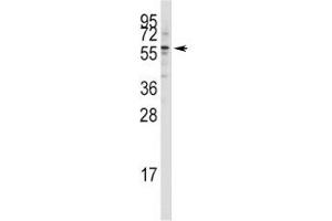 Western blot analysis of Tip60 antibody in Jurkat lysate (KAT5 anticorps  (AA 33-64))