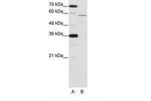 Image no. 1 for anti-Neuro-Oncological Ventral Antigen 2 (NOVA2) (AA 185-234) antibody (ABIN202652) (NOVA2 anticorps  (AA 185-234))