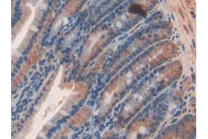 DAB staining on IHC-P; Samples: Rat Intestine Tissue (SEMA3A anticorps  (AA 31-150))