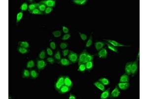 Immunofluorescent analysis of PC-3 cells using ABIN7156631 at dilution of 1:100 and Alexa Fluor 488-congugated AffiniPure Goat Anti-Rabbit IgG(H+L)