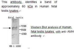 Image no. 1 for anti-Anti-Mullerian Hormone (AMH) antibody (ABIN790790) (AMH anticorps)
