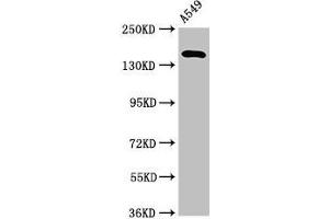Western Blot Positive WB detected in: A549 whole cell lysate All lanes: A2ML1 antibody at 3. (A2ML1 anticorps  (AA 625-751))