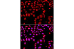 Immunofluorescence analysis of A549 cells using ARHGEF9 antibody (ABIN5975759).
