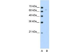 WB Suggested Anti-TOX Antibody Titration:  0.