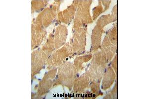 NDUFAF2 Antibody (Center) (ABIN657264 and ABIN2846359) immunohistochemistry analysis in formalin fixed and paraffin embedded human skeletal muscle followed by peroxidase conjugation of the secondary antibody and DAB staining. (NDUFAF2 anticorps  (AA 71-99))