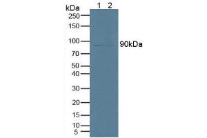 Figure. (PNPLA2 anticorps  (AA 484-701))