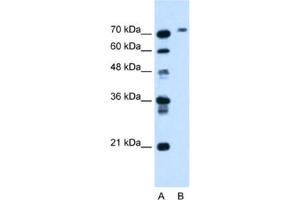 Western Blotting (WB) image for anti-Butyrylcholinesterase (BCHE) antibody (ABIN2462791) (Butyrylcholinesterase anticorps)