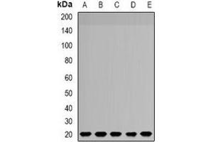 Western blot analysis of NDUFS4 expression in SW620 (A), MCF7 (B), HepG2 (C), mouse brain (D), rat liver (E) whole cell lysates. (NDUFS4 anticorps)