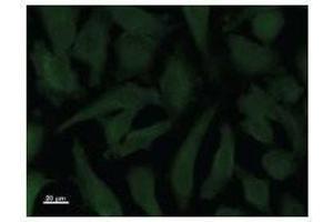 Immunostaining analysis in HeLa cells.