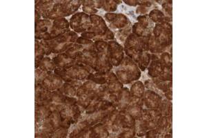 Immunohistochemical staining of human pancreas with MRPL52 polyclonal antibody  shows strong cytoplasmic positivity in exocrine glandular cells at 1:50-1:200 dilution.