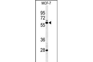 Western blot analysis of NR1H3 Antibody (Center) (ABIN653910 and ABIN2843147) in MCF-7 cell line lysates (35 μg/lane). (NR1H3 anticorps  (AA 226-253))