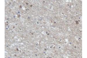 DAB staining on IHC-P; Samples: Human Cerebrum Tissue (PCDHA1 anticorps  (AA 30-242))