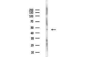 Western blot analysis of lysates from 293 cells(UV 30 min treatment), using OPRK1 Antibody at 1/1000 dilution.