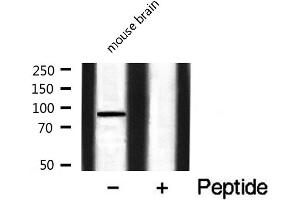Western blot analysis of FGFR3 expression in Mouse brain lysate