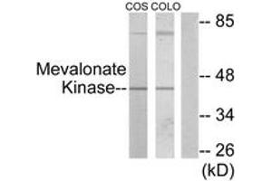 Western blot analysis of extracts from COS7/COLO205 cells, using Mevalonate Kinase Antibody. (MVK anticorps  (AA 151-200))