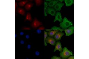 ABIN6257594 and ABIN6275624 staining Hela cells by IF/ICC. (CCT7 anticorps  (Internal Region))