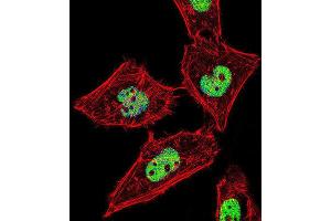 Immunofluorescence (IF) image for anti-RAR-Related Orphan Receptor A (RORA) antibody (ABIN2995882) (RORA anticorps)