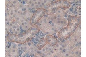 DAB staining on IHC-P; Samples: Rat Kidney Tissue