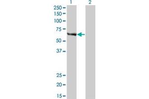 Western Blot analysis of FANCC expression in transfected 293T cell line by FANCC monoclonal antibody (M01), clone 6E7. (FANCC anticorps  (AA 1-100))