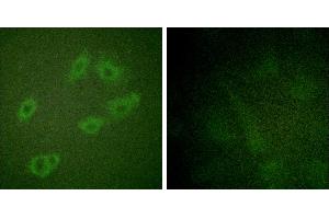 P-peptide - +Immunofluorescence analysis of HuvEc cells, using HER3/ErbB3 (Phospho-Tyr1222) antibody. (ERBB3 anticorps  (pTyr1222))