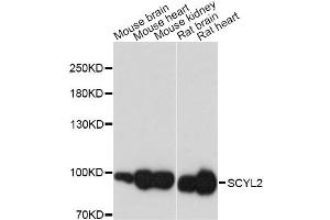 Western blot analysis of extracts of various cell lines, using SCYL2 antibody (ABIN6293549) at 1:3000 dilution. (SCYL2 anticorps)