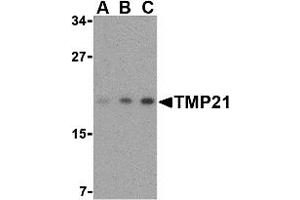 Western Blotting (WB) image for anti-Transmembrane Emp24-Like Trafficking Protein 10 (TMED10) (Middle Region) antibody (ABIN1031137) (TMED10 anticorps  (Middle Region))