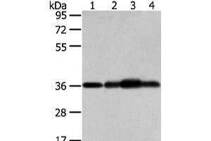 Western Blot analysis of Mouse brain tissue, hepg2, 293T and 231 cell using STX12 Polyclonal Antibody at dilution of 1/800 (Syntaxin 12 anticorps)