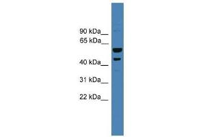 SERPINB2 antibody used at 0. (SERPINB2 anticorps  (Middle Region))