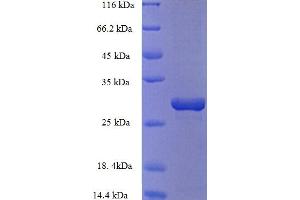 SDS-PAGE (SDS) image for Potassium Voltage-Gated Channel, Shal-Related Subfamily, Member 1 (Kcnd1) (AA 410-647), (Cytoplasmic Domain), (Cytosolic) protein (His tag) (ABIN5709789)
