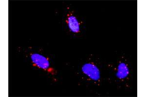 Proximity Ligation Analysis of protein-protein interactions between TP53 and CREB1. (CREB1 anticorps  (AA 1-95))