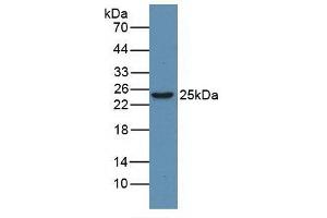 Detection of HMGB1 in Human Jurkat Cells using Monoclonal Antibody to High Mobility Group Protein 1 (HMGB1) (HMGB1 anticorps  (AA 1-215))