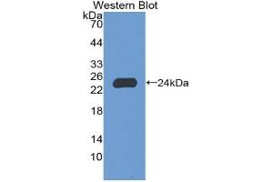 Detection of Recombinant NCF2, Human using Polyclonal Antibody to Neutrophil Cytosolic Factor 2 (NCF2)