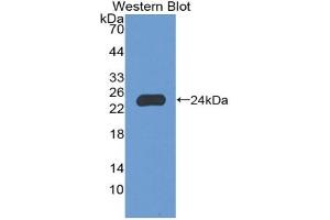 Detection of Recombinant NCF2, Human using Polyclonal Antibody to Neutrophil Cytosolic Factor 2 (NCF2) (NCF2 anticorps  (AA 355-526))