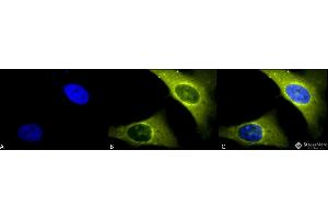 Immunocytochemistry/Immunofluorescence analysis using Rabbit Anti-Rab4 Polyclonal Antibody . (Rab4 anticorps  (C-Term) (HRP))