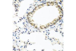 Immunohistochemistry of paraffin-embedded rat lung using BMP5 antibody.