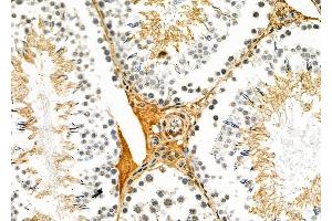 ABIN6260068 and ABIN6279106 at 1/100 staining Rat testis tissue by IHC-P. (ACER1 anticorps  (Internal Region))