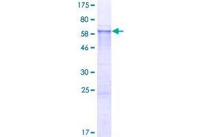 Image no. 1 for Excision Repair Cross Complementing Polypeptide-1 (ERCC1) (AA 1-323) protein (GST tag) (ABIN1353027)
