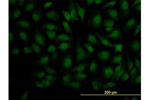 Image no. 3 for anti-Decapping Enzyme, Scavenger (DCPS) (AA 1-338) antibody (ABIN599227) (DCPS anticorps  (AA 1-338))