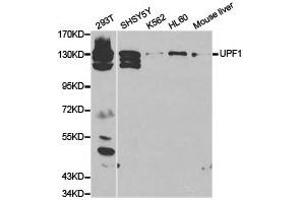 Western Blotting (WB) image for anti-UPF1 Regulator of Nonsense Transcripts Homolog (UPF1) antibody (ABIN1875284) (RENT1/UPF1 anticorps)