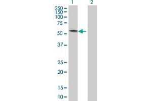 Western Blot analysis of KRT4 expression in transfected 293T cell line by KRT4 MaxPab polyclonal antibody. (KRT4 anticorps  (AA 1-534))