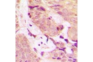 Immunohistochemistry (IHC) image for anti-TNF Receptor-Associated Factor 2 (TRAF2) antibody (ABIN7308436)