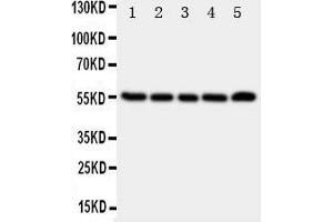 Western Blotting (WB) image for anti-Tachykinin Receptor 1 (TACR1) (AA 231-245), (Middle Region) antibody (ABIN3044262) (TACR1 anticorps  (Middle Region))