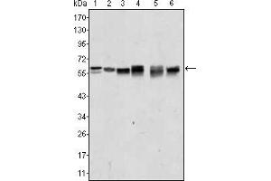 Western blot analysis using AKT2 mouse mAb against A431 (1), Jurkat (2), HEK293 (3), A549 (4), MCF-7 (5) and PC-12 (6) cell lysate. (AKT2 anticorps)