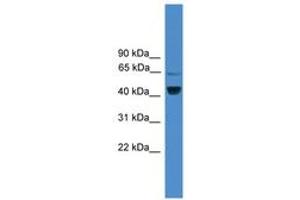 Image no. 1 for anti-Zinc Finger Protein 265 (Zranb2) (AA 101-150) antibody (ABIN6745453) (ZNF265 anticorps  (AA 101-150))