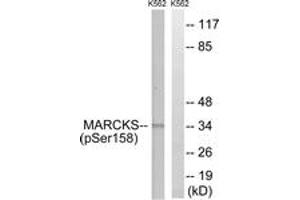 Western Blotting (WB) image for anti-Myristoylated Alanine-Rich Protein Kinase C Substrate (MARCKS) (pSer158) antibody (ABIN2888464) (MARCKS anticorps  (pSer158))