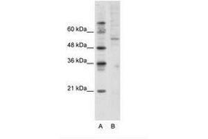 Image no. 1 for anti-Activating Transcription Factor 7 (AFT7) (C-Term) antibody (ABIN202638) (AFT7 anticorps  (C-Term))