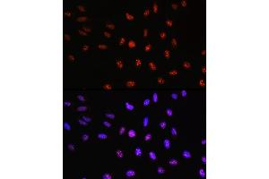 Immunofluorescence analysis of U-2 OS cells using TCF4 Rabbit pAb (ABIN3021529, ABIN3021530, ABIN3021531, ABIN1513591 and ABIN6215200) at dilution of 100 (40x lens).
