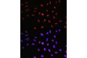 Immunofluorescence analysis of U-2 OS cells using TCF4 Rabbit pAb (ABIN3021529, ABIN3021530, ABIN3021531, ABIN1513591 and ABIN6215200) at dilution of 100 (40x lens). (TCF4 anticorps  (AA 400-500))